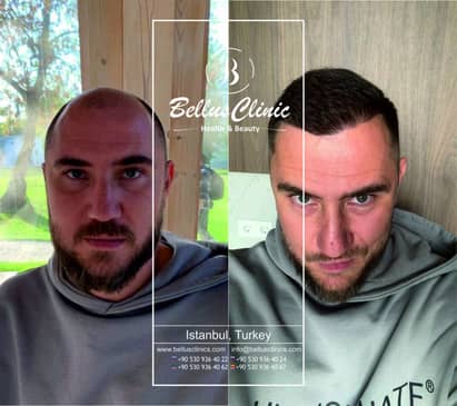 Slider image (5) Bellus Clinic